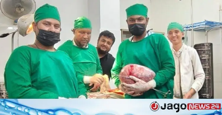 ৬৫‑বছর‑বয়সী নারীর পেট থেকে ৬.৪৫ কেজি টিউমার অপসারণ