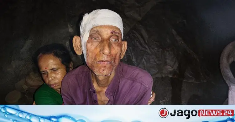মানিকগঞ্জে রডের আঘাতে ৩ জন আহত, ফাঁকা গুলি ছুড়ে সোনা-রুপা ছিনতাই